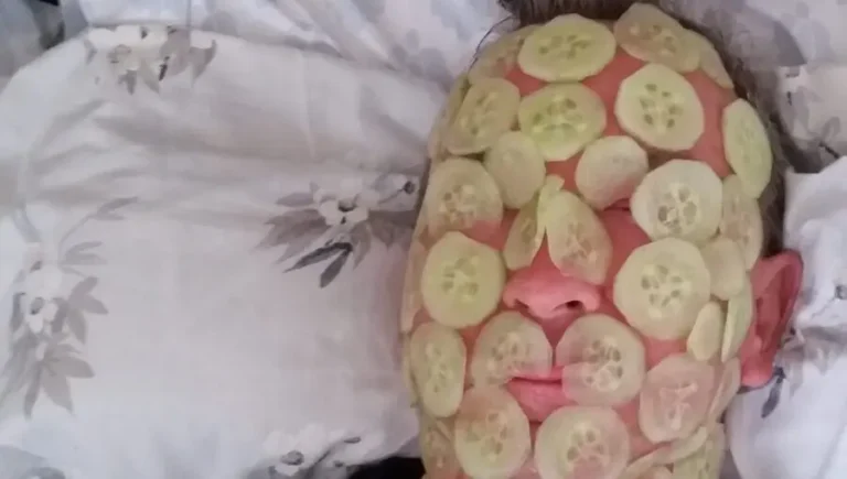 A man's face with slices of fresh cucumber placed on it.